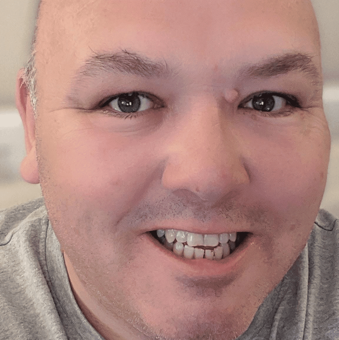 Mike Arnopp